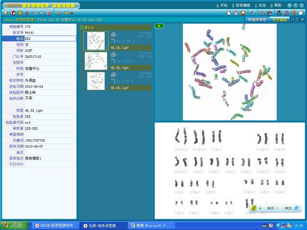 染色體圖像分析系統