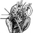 腮腺手術 腮腺手術