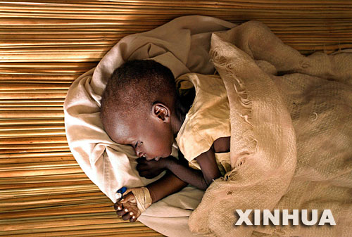烏干達一名嚴重營養不良的兒童躺在蓆子上