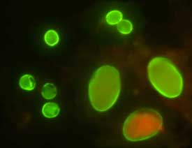 隱孢子蟲蟲卵螢光抗體染色