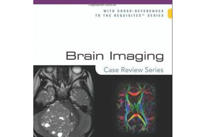 Brain Imaging Brain Imaging