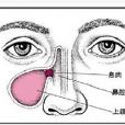 鼻病門 鼻病門