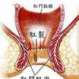 肛門裂