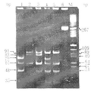 ApoE基因PCR產物HhaⅠ酶切後RFLP圖譜
