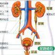 鈣結石 鈣結石