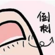 手倒刺 手倒刺
