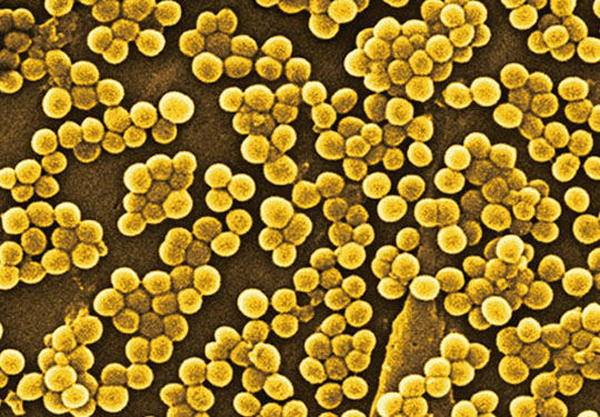 耐甲氧西林金黃色葡萄球菌(MRSA)