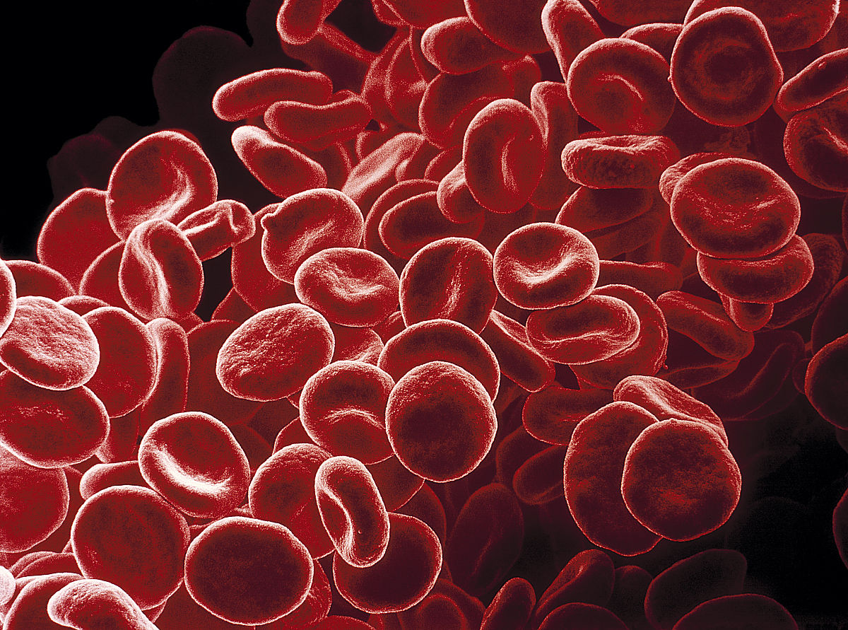 紅細胞平均血紅蛋白濃度