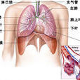 支氣管炎疫苗