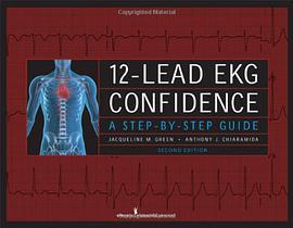 12- Lead EKG Confidence 12- Lead EKG Confidence