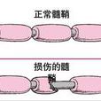 脫髓 脫髓