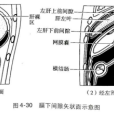 膈下間隙 膈下間隙