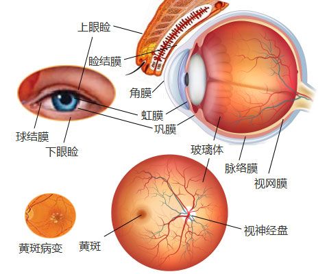 青盲症 青盲症