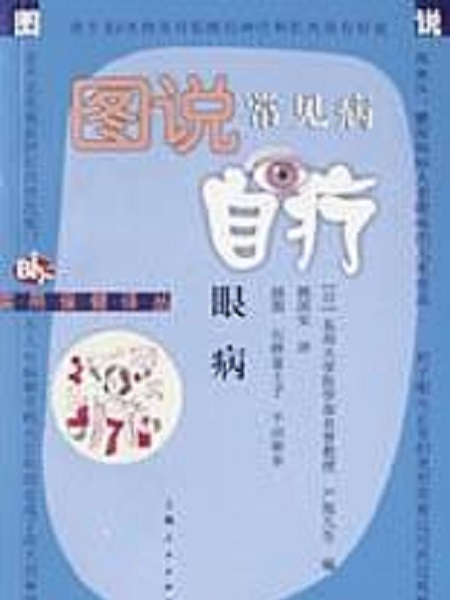 眼病 眼病