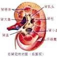 巨腎盞 巨腎盞