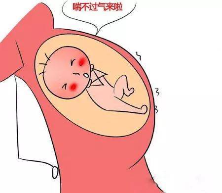 胎內窒息
