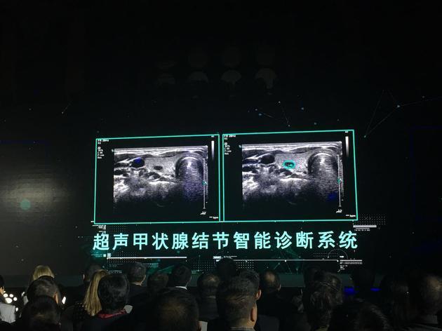 ET醫療大腦 ET醫療大腦