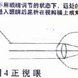 正視眼