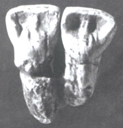 元謀人牙齒化石