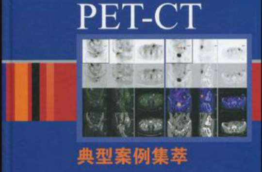 PET-CT典型案例集萃