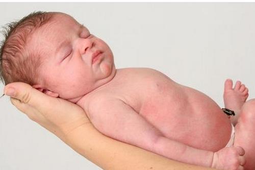 適於胎齡兒 適於胎齡兒