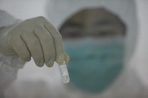 甲型H1N1流感疫苗毒株