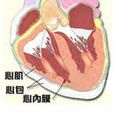 心包積液體徵