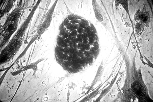 人類胚胎幹細胞群