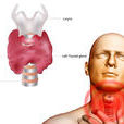 甲狀腺腫(大脖子病)