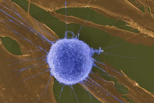 T淋巴細胞(胸腺依賴淋巴細胞)