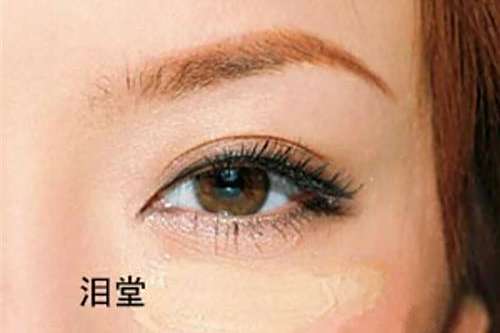 淚堂痣 淚堂痣