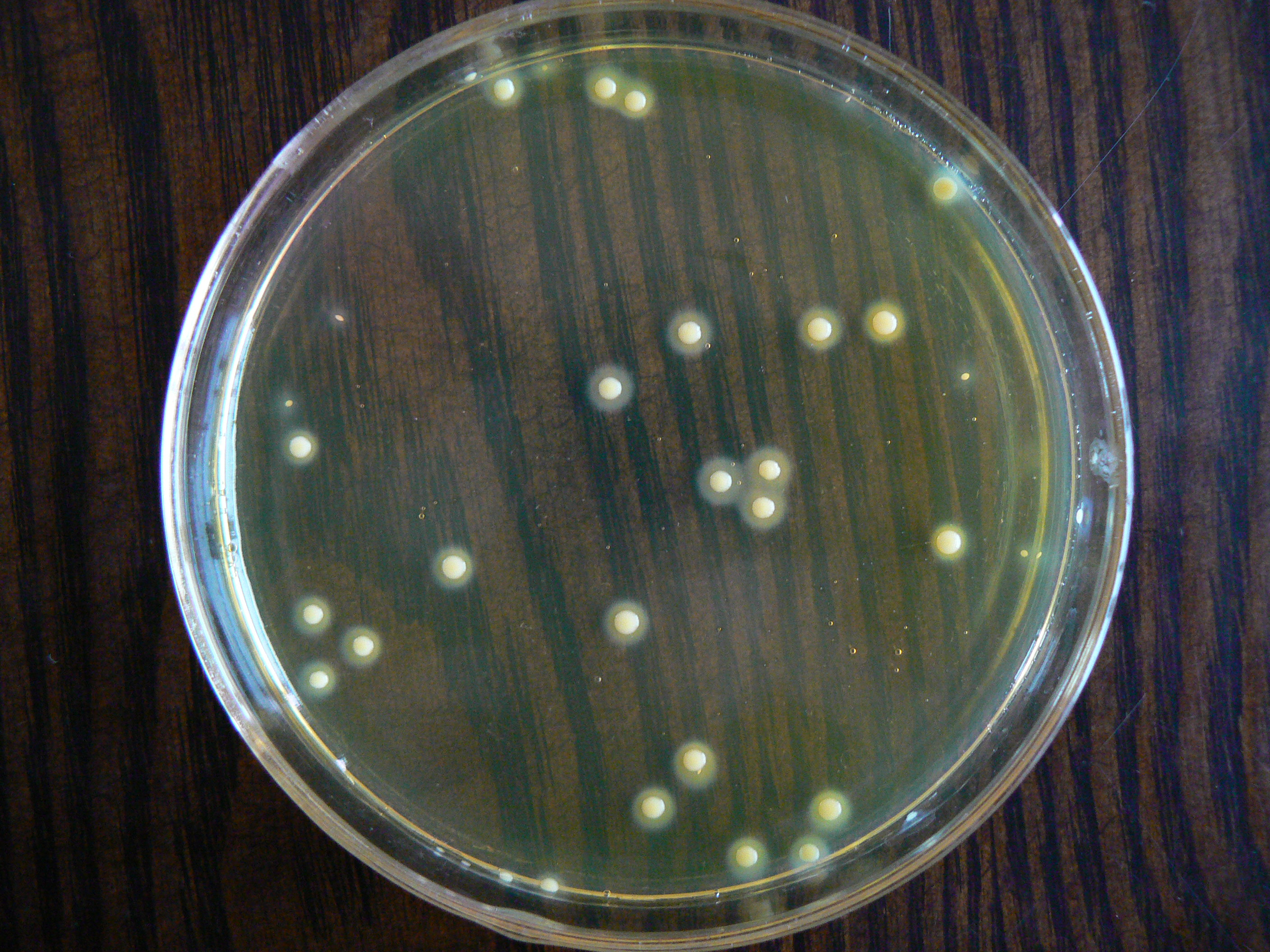 金黃色葡萄球菌普通培養基培養特點