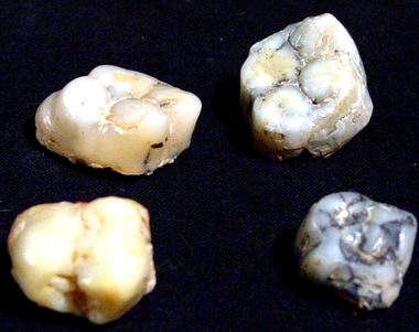 甘前人牙化石