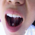 舌下片