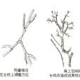 骨幹枝 骨幹枝