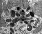 細胞器-溶酶體