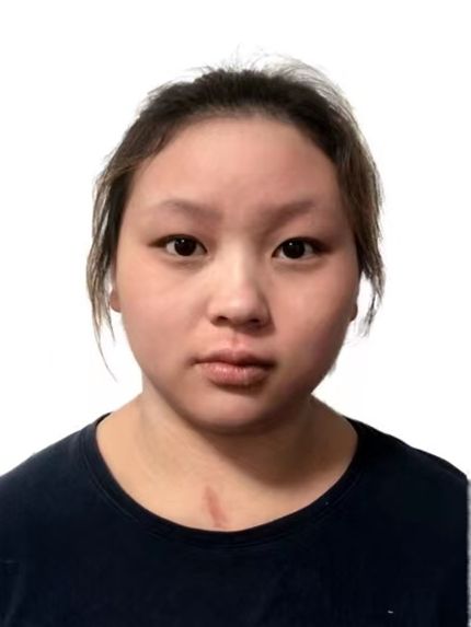 俞嘉琪(女子舉重運動員) 俞嘉琪(女子舉重運動員)