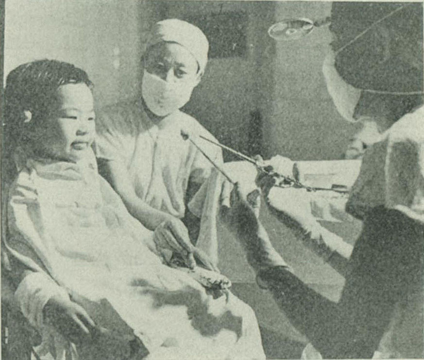 在針刺麻醉下為兒童摘除扁桃體