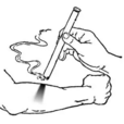 熱敏懸灸 熱敏懸灸