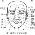 面針療法 面針療法