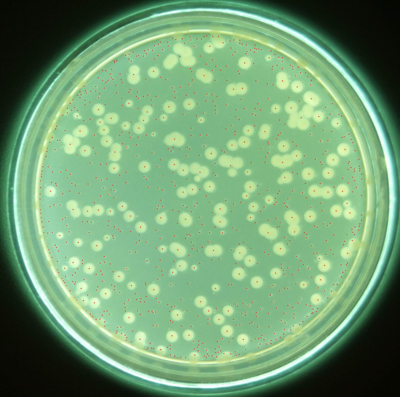 銅綠假單胞菌