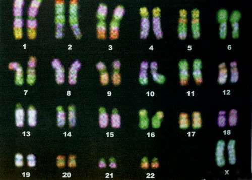 在人類的體細胞中發現的23對染色體