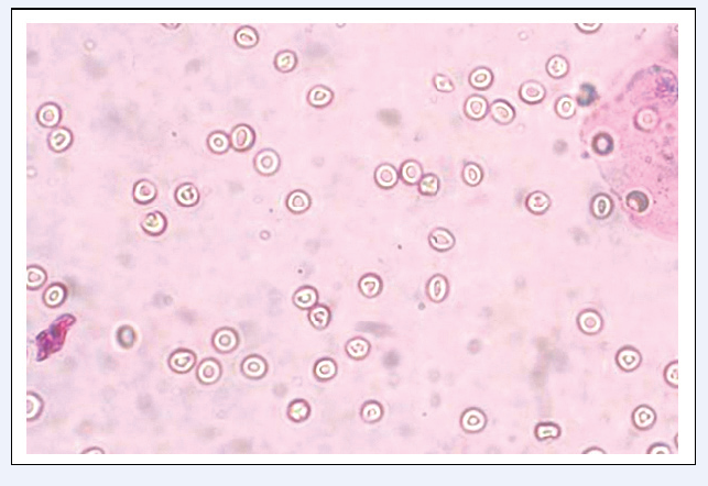 圖3 正常紅細胞（SM染色）
