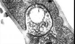白喉桿菌的細胞膜和中間體