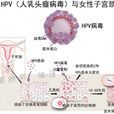 HPV病毒