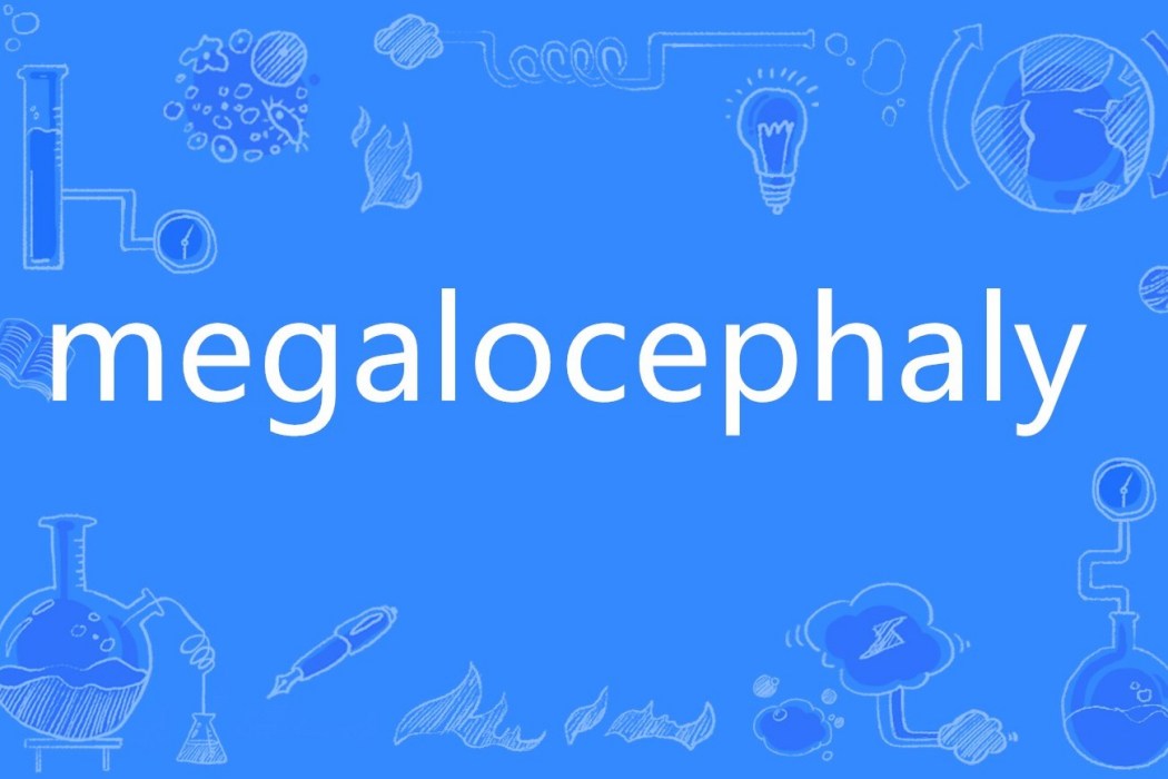 megalocephaly megalocephaly