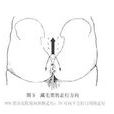皮毛竇 皮毛竇