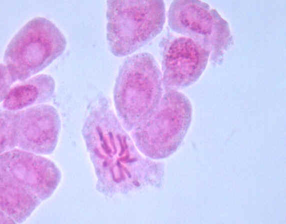 顯微鏡下的血紅蛋白
