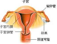 子宮內膜炎症圖片