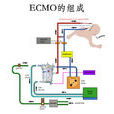 ECMO--體外膜肺氧合